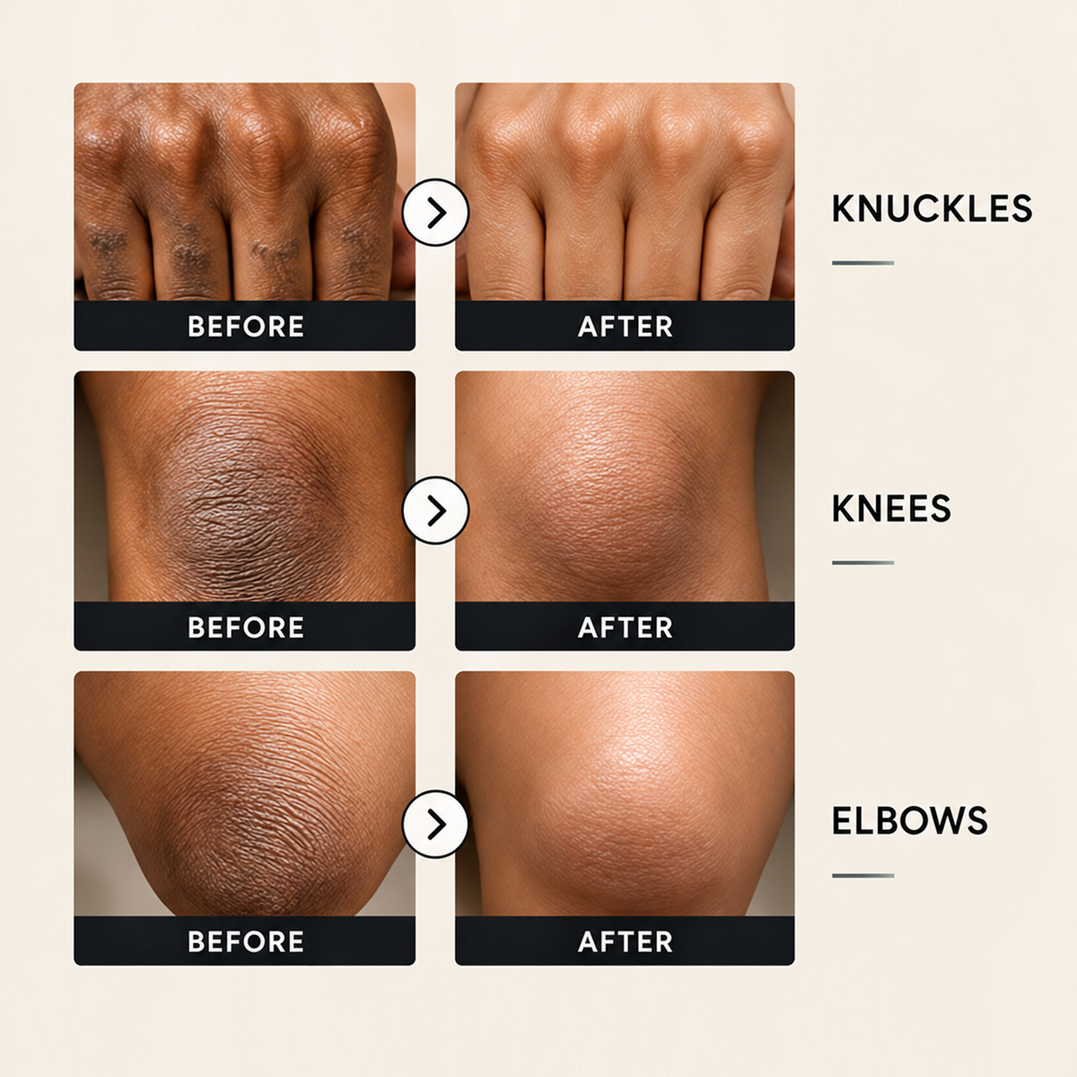 KNUCKLE RECOVERY